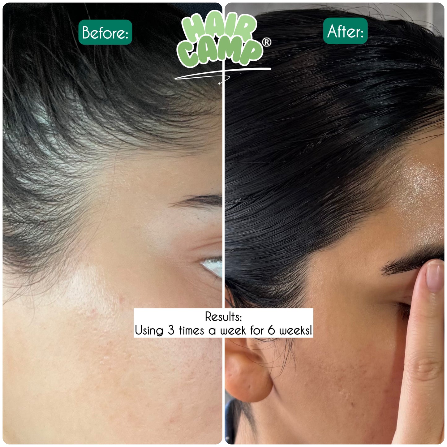 Glow 'N' Grow Hair Oil 300ML